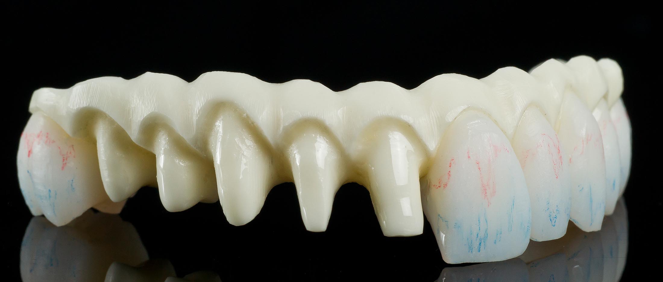 Precision Dental Arts